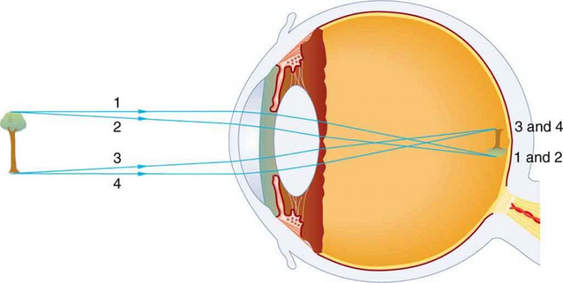 Ray diagram in the picture shows the internal structure of an eye and a tree that is taken as an object. An inverted image of the tree is formed on retina with the light rays coming from the top and bottom of the tree; converging most at the cornea and upon entering and exiting the lens. The rays coming from top of the tree are labeled one, two, while the bottom rays are labeled three, four. The inverted image of the tree shows rays labeled three, four at the top and one, two at the bottom.