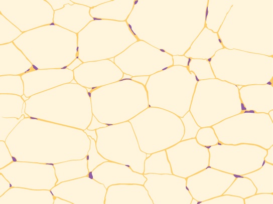 Illustration shows irregularly shaped cells with tiny nuclei clustered next to the cell’s outer membrane.