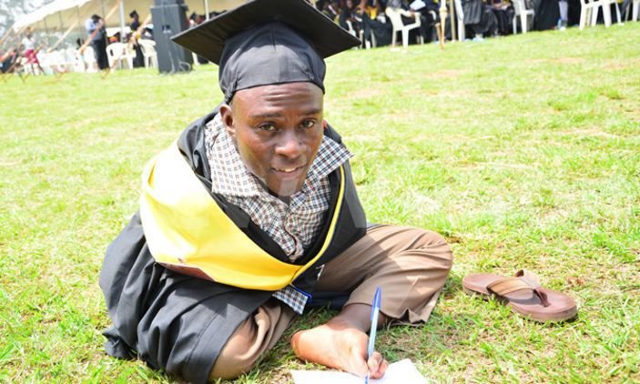 young-man-without-hands