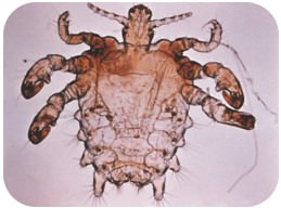 Pubic Lice