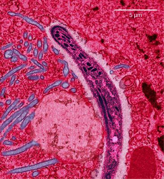 Photo b shows a micrograph of sickle-shaped Plasmodium falciparum, the parasite that causes malaria. The Plasmodium is about 0.75 microns across.
