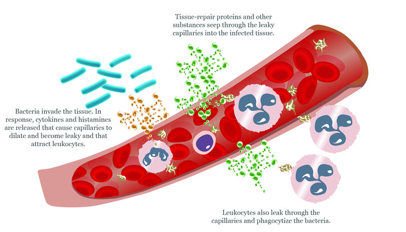 Elements of an inflammatory response